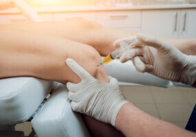 Platelet-rich plasma injection of the knee