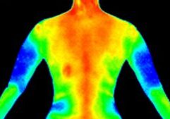 Thermography