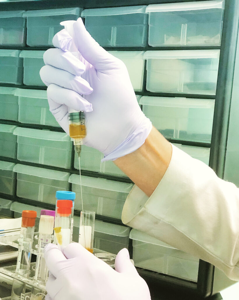 regenerative-injection-therapy-prp-bellevue